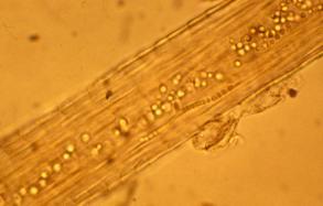 Penetrate skin at abrasions Spores germinate - hyphae penetrate stratum