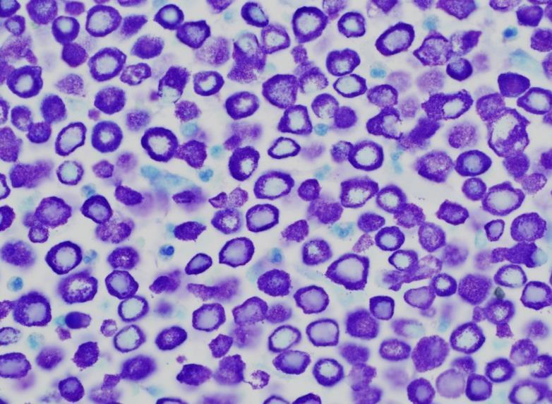 Mast cell neoplasia 3.