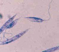BACKGROUND Leishmaniosis parasitic disease of