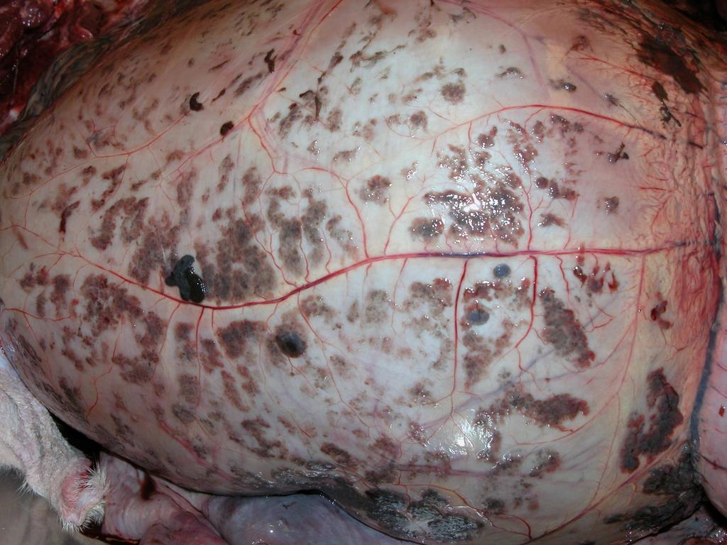 Liver Fluke Infection (fasciolosis) can be divided into three forms: Acute fasciolosis occurs in an outbreak form where the pastures are contaminated massively with larval stage of flukes.