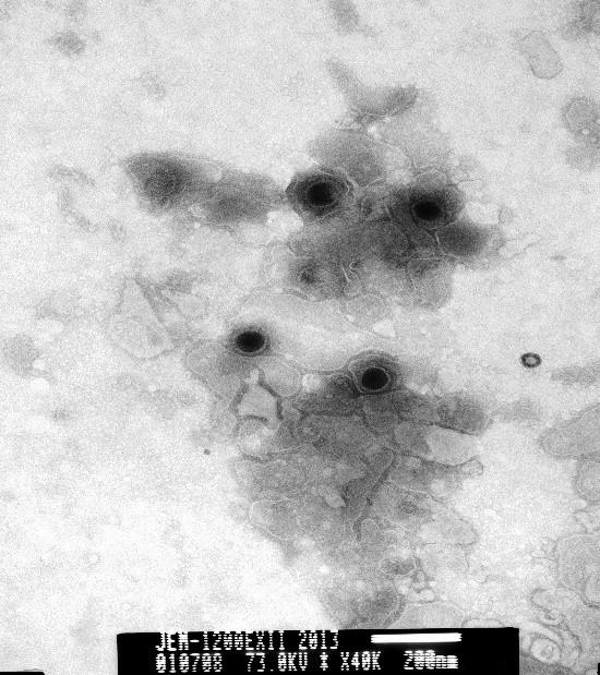 Viruses 2014, 6 1008 Figure 4. Negative-stained electron micrograph of FHV-1 particles.