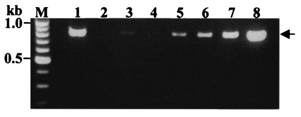 lanes 26 to 32, Asian genotype of T. solium. The lane numbers correspond to the lanes shown in Table 1. (B) Confirmation by multiplex PCR of cysticerci developed in immunodeficiency mice.