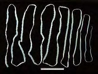 1 of 6 1/3/2017 12:20 PM From Wikipedia, the free encyclopedia Cestoda (Cestoidea) is a class of parasitic flatworms of the phylum Platyhelminthes. Biologists informally refer to them as cestodes.