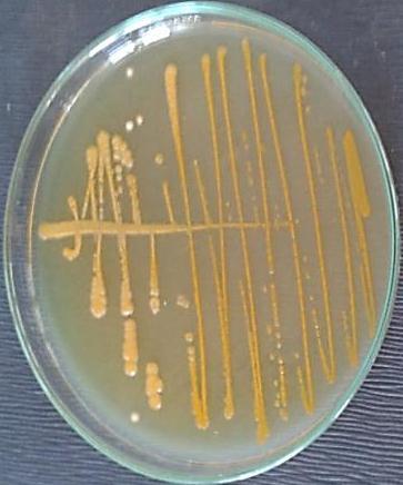 It was on this background the present study was conducted to detect the presence of extended spectrum beta-lactamase producing Escherichia coli in community-acquired and hospital-acquired urinary