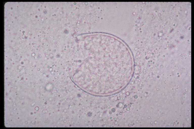 RUPTURED SPHERULE Not contagious person-to-person; infection occurs by inhaling arthrospore No animal-to-person transmission Lab workers face hazard Animals at risk: