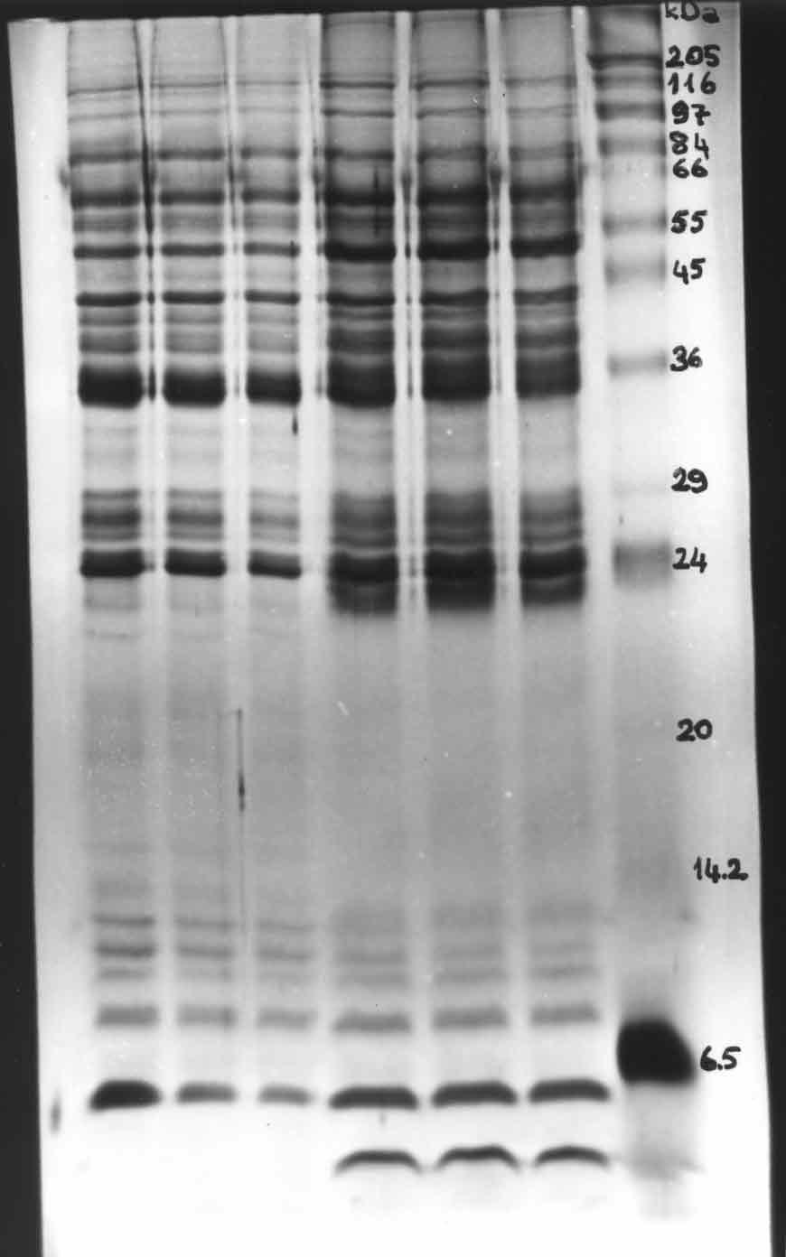 B. GÖNENÇ, H. O. SARIMEHMETO LU, M. KARA, F. KIRCALI Figure 4. Detected protein bands in E/S antigens of Fasciola hepatica using SDS-PAGE. Figure 5.