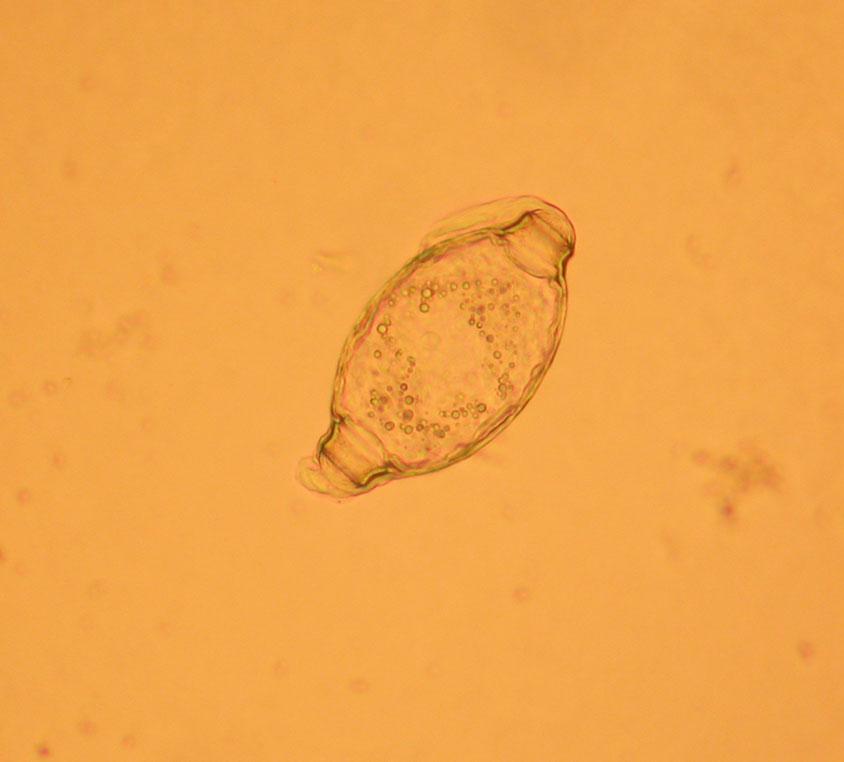 The body of the mature female contained a huge number of eggs measuring 95 05 x 40 65 µm, with characteristic cones (5 x 5 µm) and filaments 57.5 62.5 µm long (Fig. 4) on both poles.