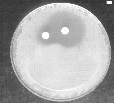 The isolates - were further studied for inducible clinda- 3 mycin resistance as per CLSI guidelines. A 0.5 McFarland equivalent suspension of organism was inoculated on to Mueller Hinton agar plates.