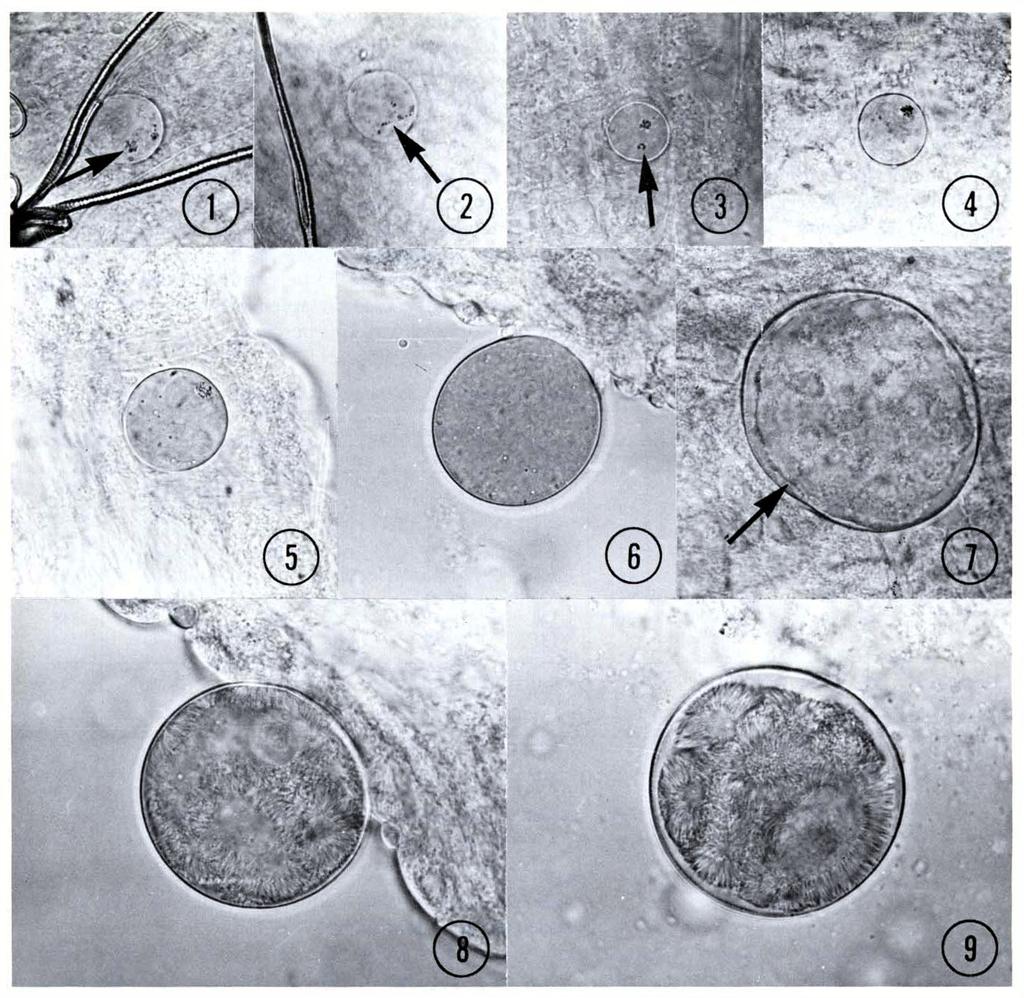 PLASMODIUM COATNEYI 293 PLATE XLVI. Developing oocysts of Plasmodium coatneyi in Anopheles b. balabacensis mosquitoes. X 580. Fig. 1. 6-day oocyst showing clumped pigment. Fig. 6. 9-day oocyst. Fig. 2. 6-day oocyst showing linear arrangement of Fig.