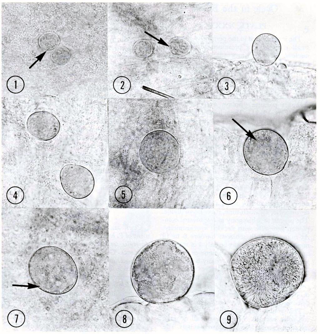 296 PRIMATE MALARIAS PLATE XLVII. Exoerythrocytic bodies of Plasmodium coatneyi in liver tissue of Macaca mulatta monkeys. X 580 (Except Fig. 6). Fig. 1. 6-day body. Fig. 6. 9-day body. X 740. Fig. 2.