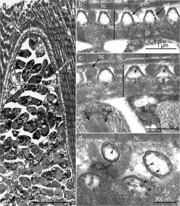 7 Fig 2 TEM of S. heydorni sarcocyst walls in tongue of calf 2.