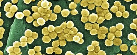 Is biocide resistance already a