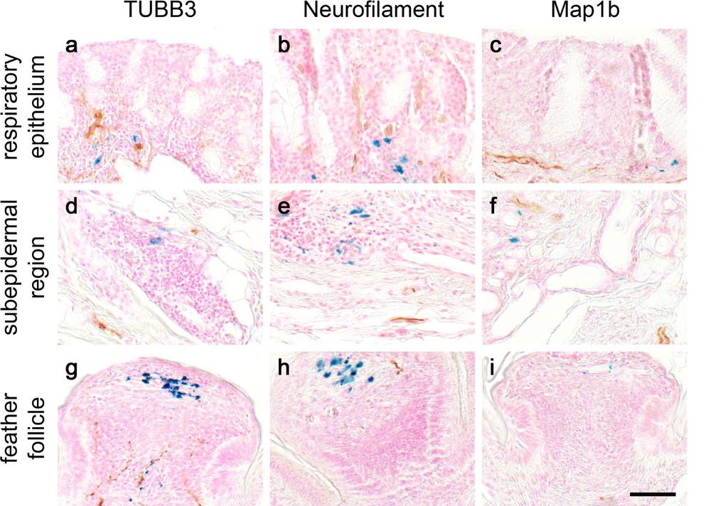Supplementary Figure 10: Neuronal immunostaining (a-i) Representative images of coronal sections triple stained with PB, NFR, and three different neuronal markers: TUBB3 (a,d,g), neurofilament