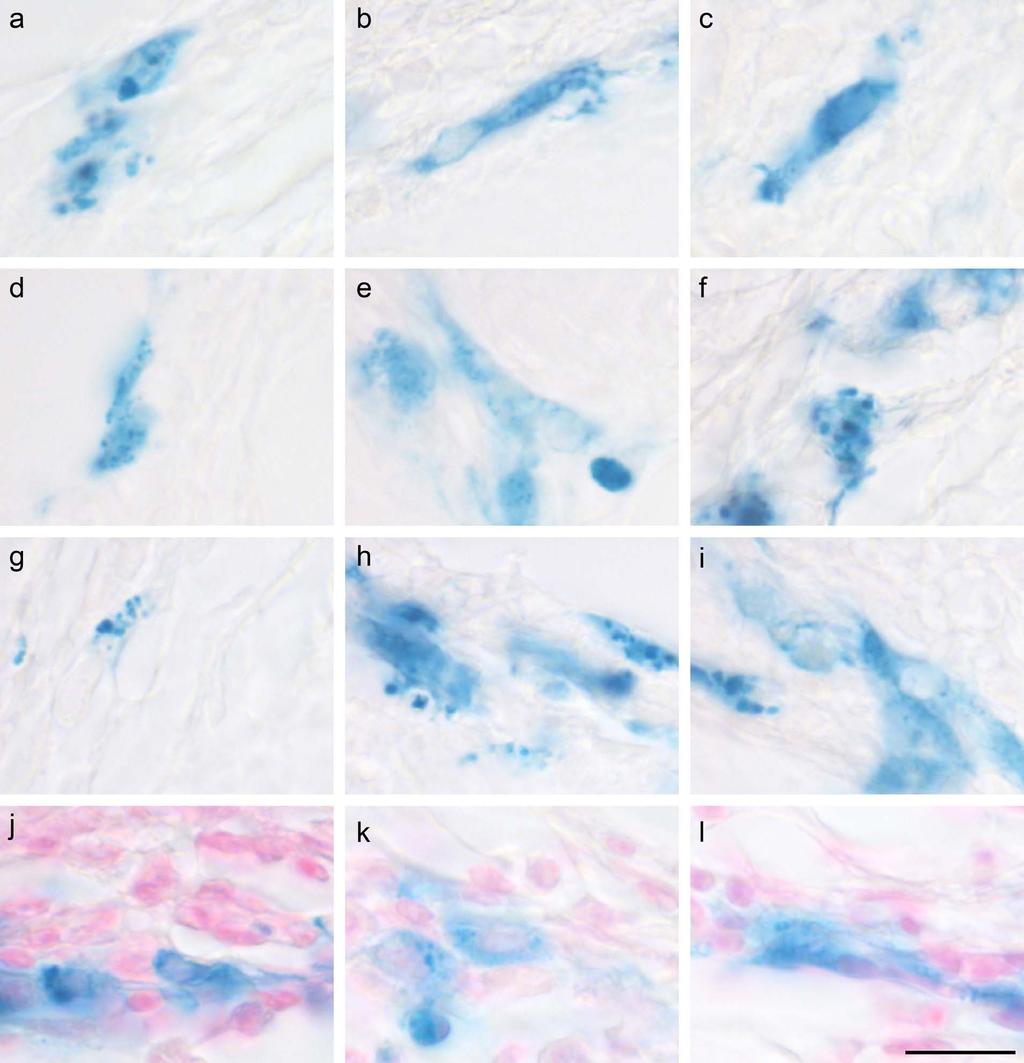 Supplementary Figure 3: Images of PB-positive cells in the respiratory epithelium (a-i) Representative images of PB positive cells in the respiratory epithelium of the upper beak of the pigeon.