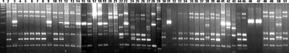 Metallo-b-lactamases in Indian A. baumannii isolates Fig. 1. RAPD fingerprinting of representative clinical isolates of A. baumannii including the reference strain A. baumannii ATCC 19606 T.