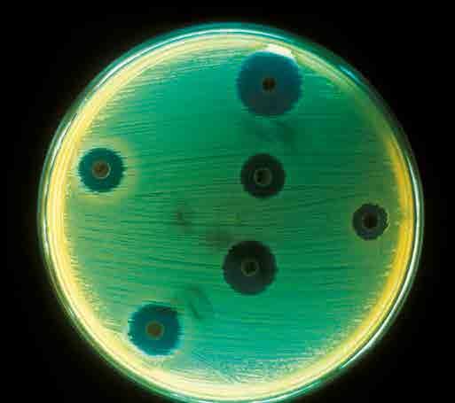 Staphylococcus aureus antibiotics test plate. CDC Public Health Image Library/Don Stalons HOW DOES ANTIBIOTIC RESISTANCE DEVELOP? Bacteria are quick to evolve resistance to antibiotics.