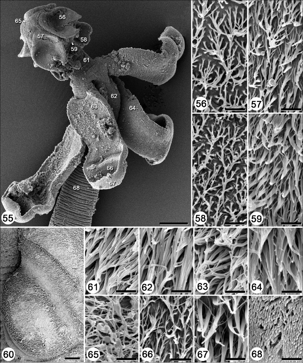 Figs. 55 68. Scanning electron micrographs of Rhoptrobothrium limae sp. n. Fig. 55. Scolex. Note: Numbers correspond to the figures showing higher magnification images of these surfaces. Fig. 56.