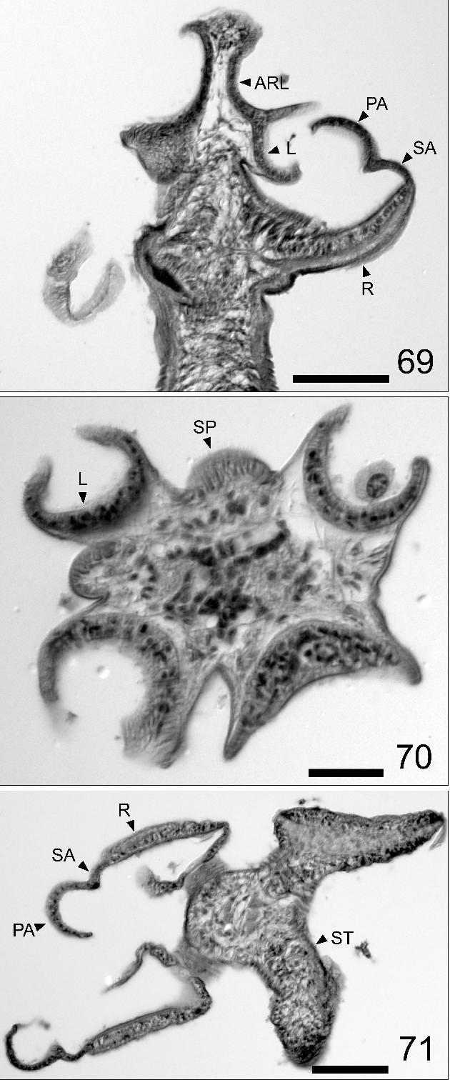 Jensen, Caira: Status of Rhoptrobothrium Figs. 69 71. Histological sections of the scolex of Rhoptrobothrium sp. Fig. 69. Longitudinal section through the scolex. Fig. 70.