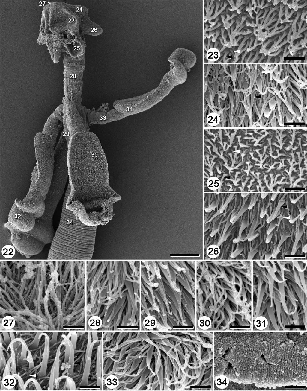Figs. 22 34. Scanning electron micrographs of Rhoptrobothrium chongi sp. n. Fig. 22. Scolex. Note: Numbers correspond to the figures showing higher magnification images of these surfaces. Fig. 23.