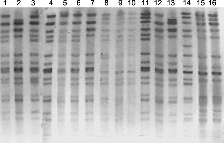 3616 NOTES ANTIMICROB. AGENTS CHEMOTHER. FIG. 1. SmaI-digested chromosomal DNA of vancomycin-susceptible and vancomycin-resistant E.