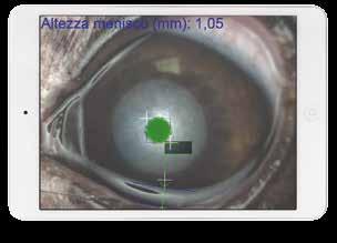 μm thick on the central cornea, but