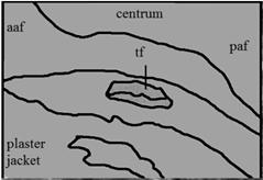surface of the centrum of vertebra 14.