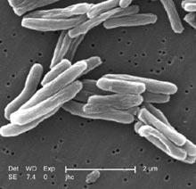 Bovine TB: The Bacteria M.