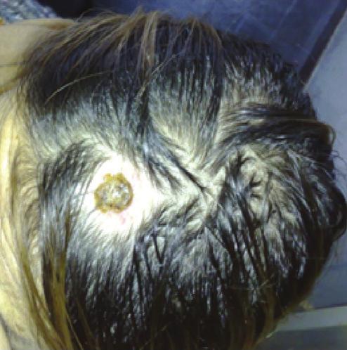 rickettsia-infected ticks. In Europe, several Rickettsia species are responsible for tick-borne rickettsioses 24.