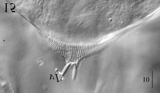 FIGURES 15-16. Aethosolenia laselvensis gen. nov., sp. nov. (Female). 15, naso, dorsal view; 16, prodorsal and anterior opisthodorsal region, sclerite arrowed. Scale bars in micrometres.