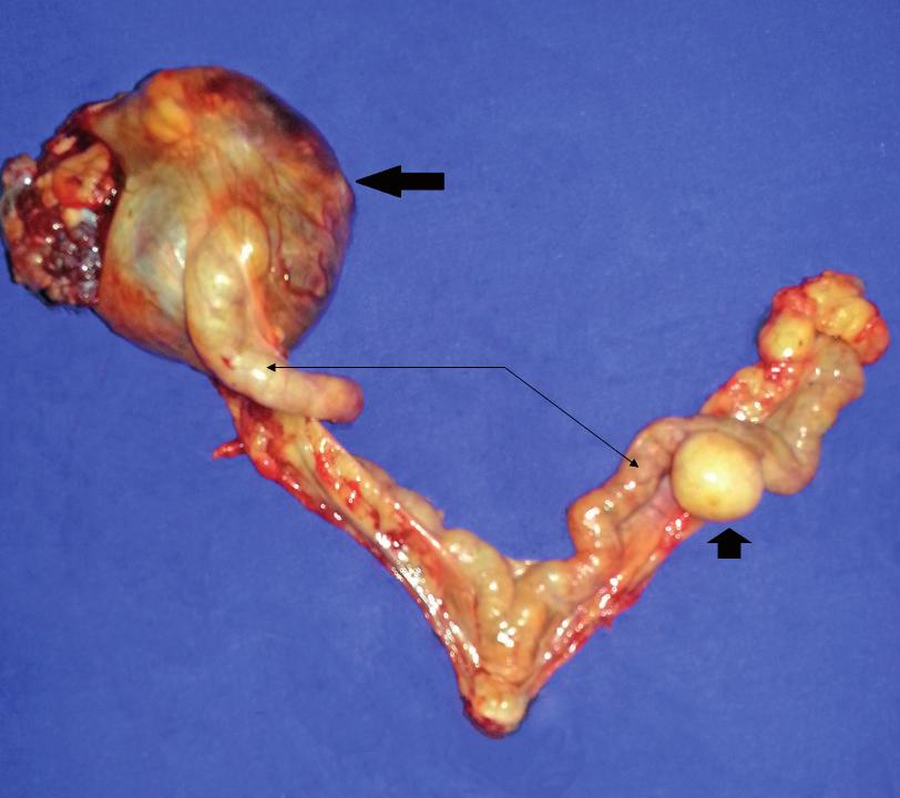 Figure 1. Yorkshire Terrier bitch ventral view. Abdominal enlargement, telangiectasis, comedones, and hypotrichosis at physical examination. Figure 2.