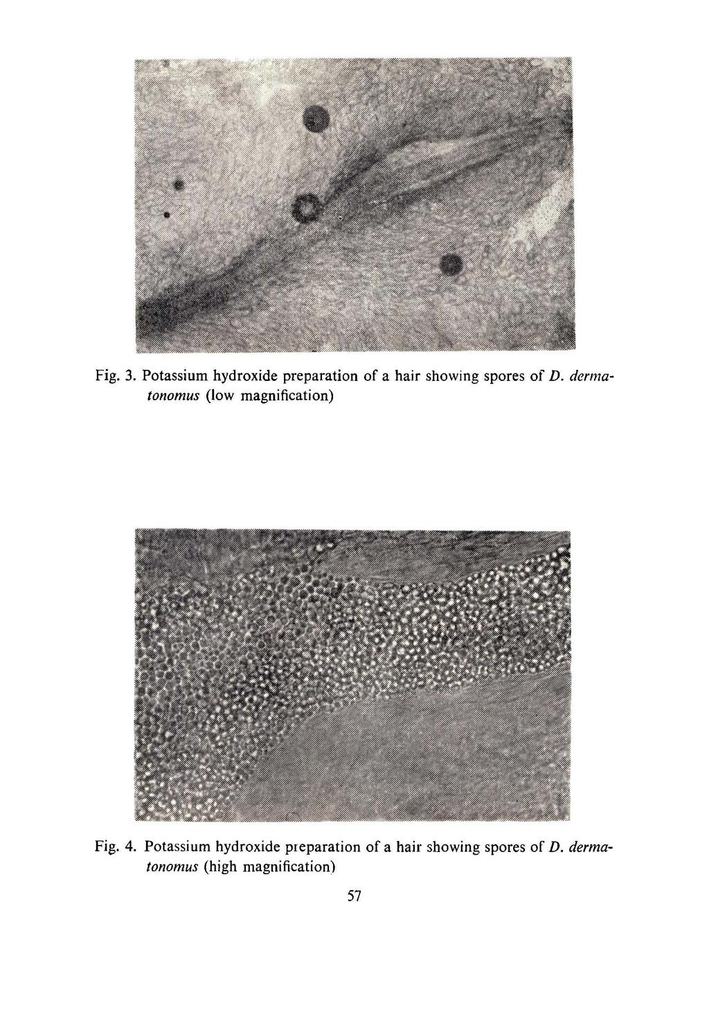 Fig. 3. Potassium hydroxide preparation of a hair showing spores of D.