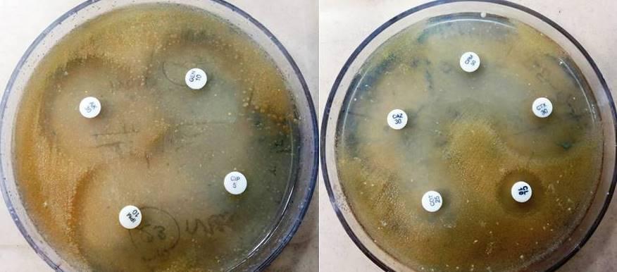 Fig.4 Antibiotic susceptibility testing in Mueller Hinton agar for P.