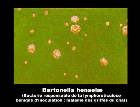 21 Diagnosis of Bartonella