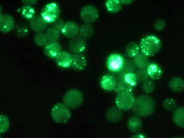 stain, Acridine orange staining) confirmation by Fluorescent
