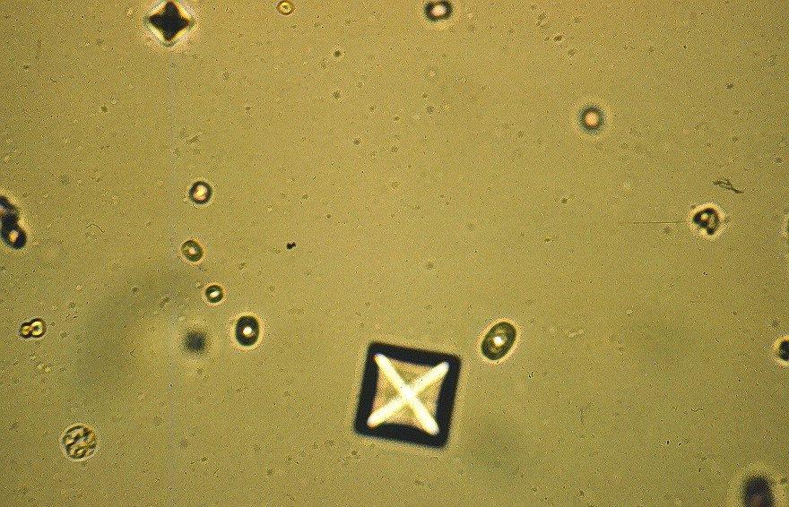 Artifacts Glove powder crystals Sloughed skin cells (fingerprints) Sample
