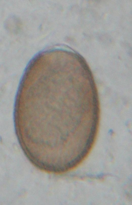 Description of the oocyst of Eimeria intricata in sheep The oocysts of the species collected from the sheep are thick, brownish double layered and rough. The outer layer is 2.