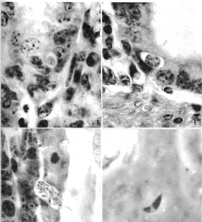 Fig. 11. Early second-generation schizont of E. bovis; fixed in Reily's and stained with iron-hematoxylin, X1400.
