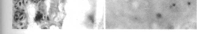 stained with iron-hematoxylin, XI400. Fig. 13. Mature second-generation schizont of E.