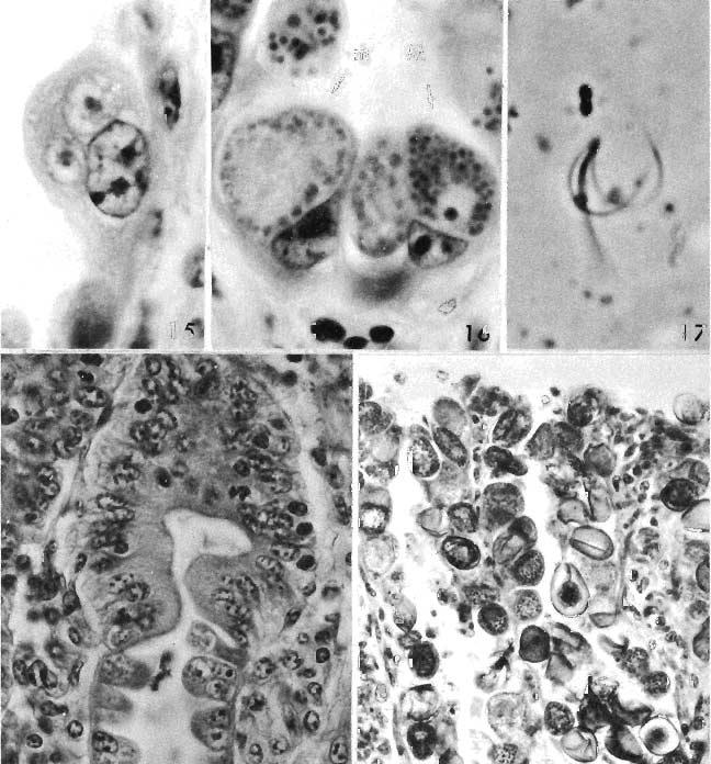 t.. {~/, Fig. 15. Two early gametocytes of E. bovis in the same host cell; X1400. Fig. 16. Intermediate gametocytes of E.