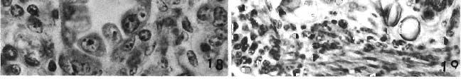 Early gametocytes of E. bovis, with alteration of infected cells (below) as compared with normal cells (above); X600. Fig. 19.