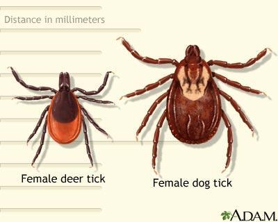 Ticks & Lyme Lyme disease is caused by the bacteria Borrelia