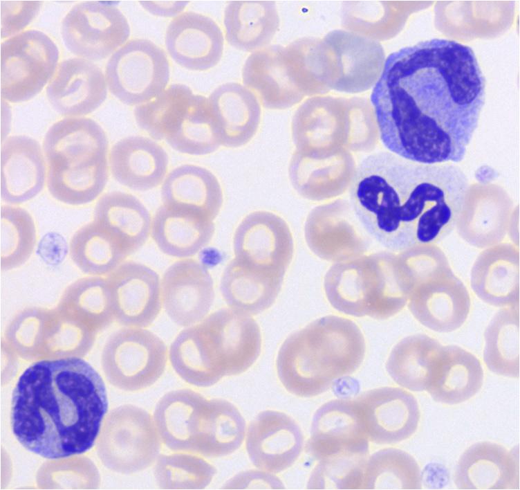 Figure 11 A, B + C. A) Two monocytes and 1 neutrophil from another dog without Hepatozoon infection.