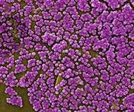 MRSA Methicillin-resistant Staphylococcus aureus Spread in hospitals and with close physical contact (e.g.