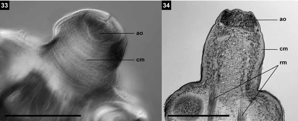 S. de Chambrier, A. de Chambrier: New tapeworms from Australia Figs. 33, 34. Vandiermenia beveridgei gen. et sp. n. Paratype (SAM 32339). Photomicrographs. Fig. 33. Pyramidal apex showing the apical part retracted.