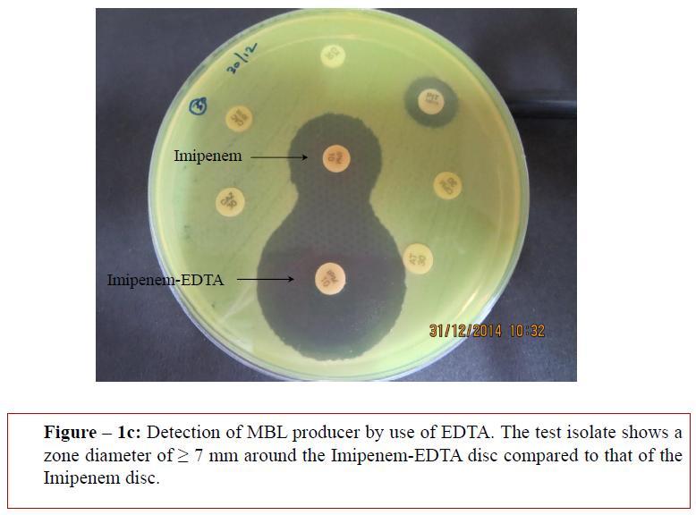 Table 1: Screening of ESBL, AmpC, MBL and MRSA: Resistance Antibiotic used Interpretation MRSA Cefoxitin (30µg) Resistant ESBL Ceftazidime (30µg)