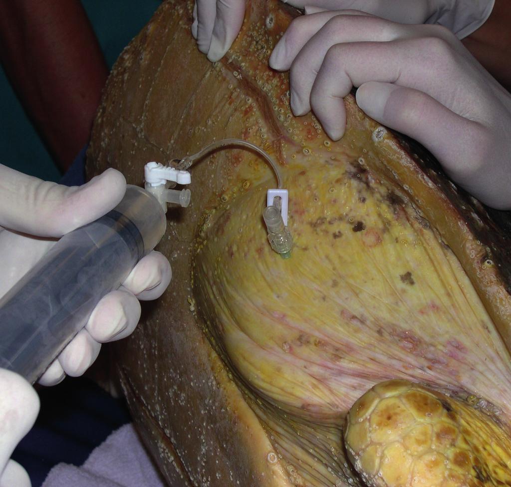 Fig. 9. Removal of air from the coelomic cavity of a loggerhead turtle with buoyancy problems.