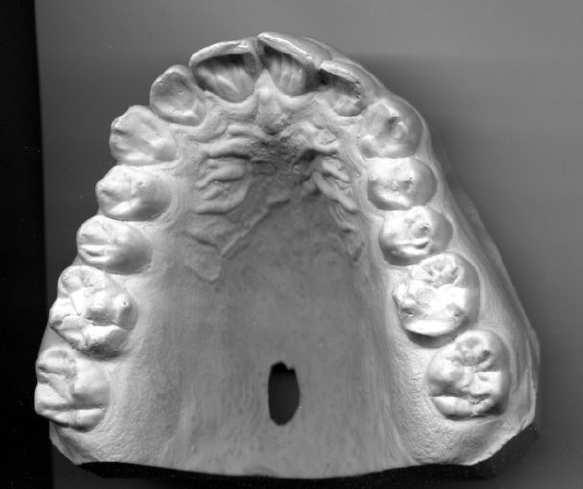 Slide 6 / 22 Molars The number of molars present in animals varies greatly. How many do you have?