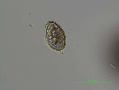 Diphyllobothrium latum Diphyllobothrium latum fish tapeworm (Deplazes et al 2017) Diphyllobothrium latum