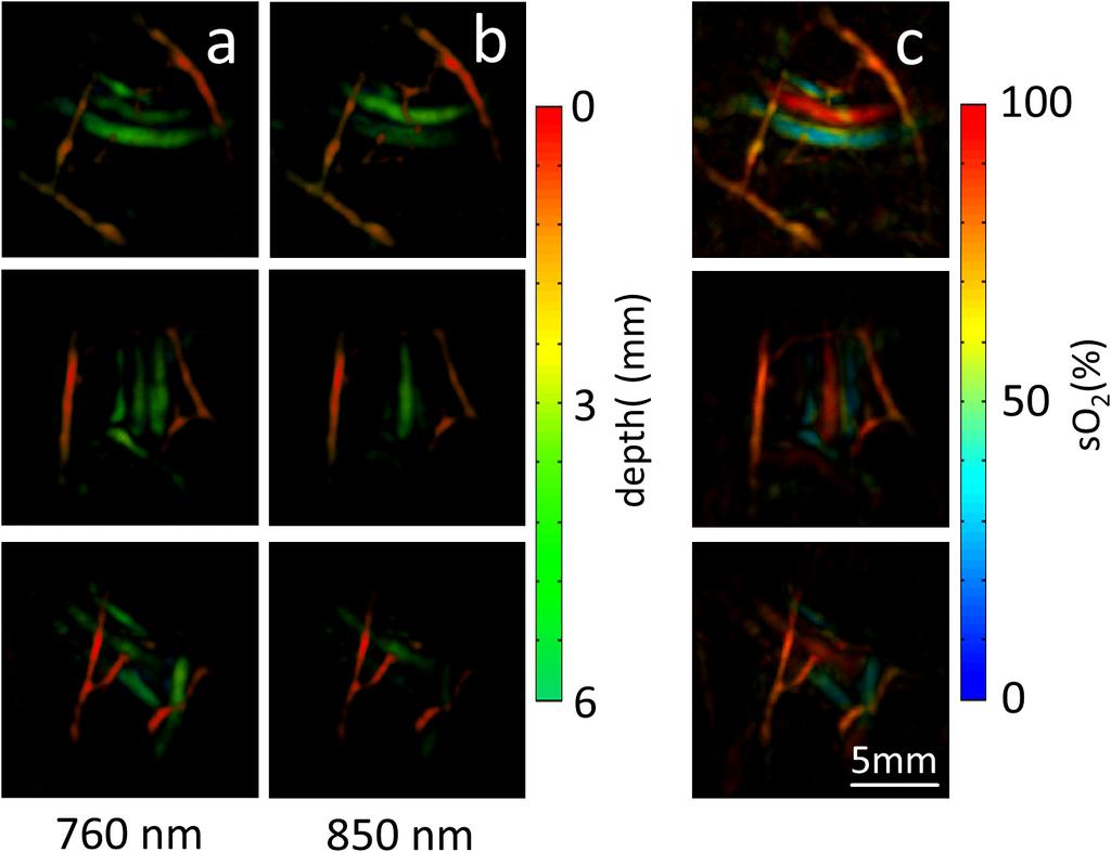 Figure 3 Optoacoustic images of tissue vasculature in a healthy volunteer acquired using the three-dimensional handheld probe and the developed microsecond delay approach.