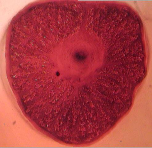 radially arranged respiratory holes x 40 Fig.